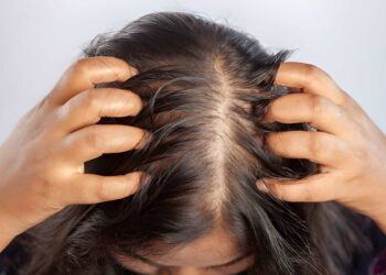 hair falling, head louse, hair care, frizzy, messy, blading scalp