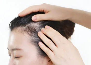 scalp