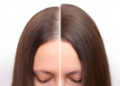 Before and after head shot of a young woman with a receding hairline on her forehead and parting