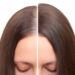 Before and after head shot of a young woman with a receding hairline on her forehead and parting