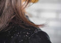 Woman hair with dandruff falling on shoulders