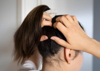 Young Woman Scratching Her Itchy Head