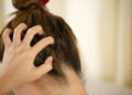 A woman has problems with hair and scalp