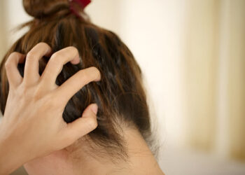 A woman has problems with hair and scalp