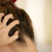 A woman has problems with hair and scalp