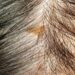 Hidden scalp buildup