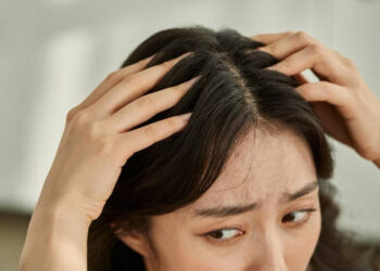Woman Worried about Hair Loss and Dandruff