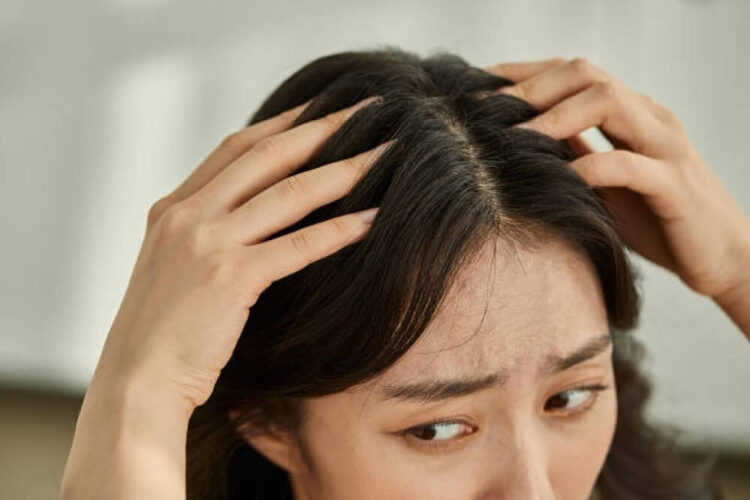 Woman Worried about Hair Loss and Dandruff