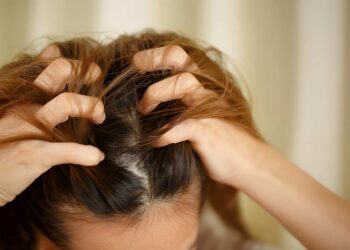 A woman has problems with hair and scalp