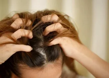 A woman has problems with hair and scalp