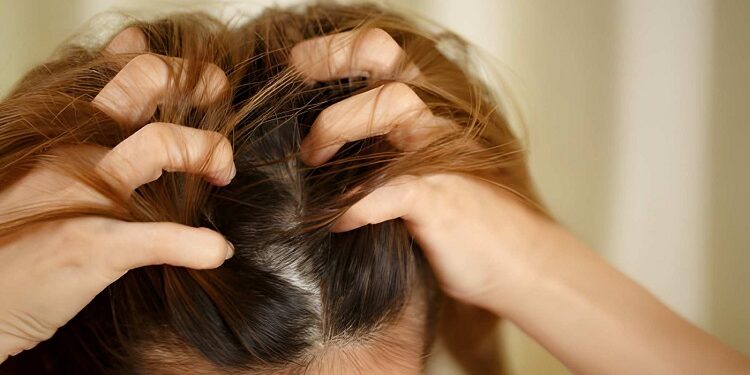 A woman has problems with hair and scalp