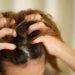 A woman has problems with hair and scalp