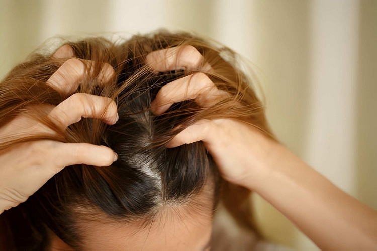 A woman has problems with hair and scalp