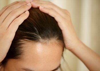 A woman has problems with hair and scalp
