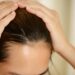 A woman has problems with hair and scalp