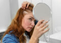 Hair Thinning