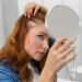 Hair Thinning