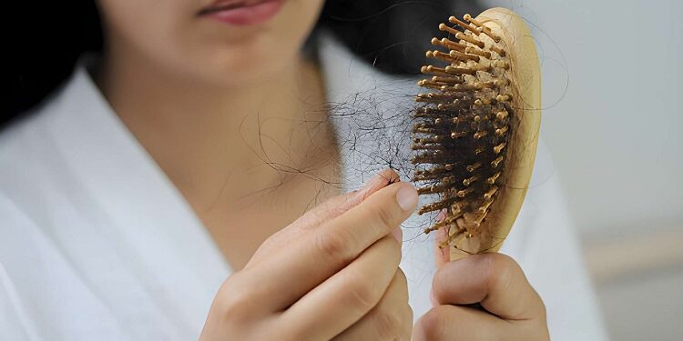 Women with hair loss dryness and frizziness