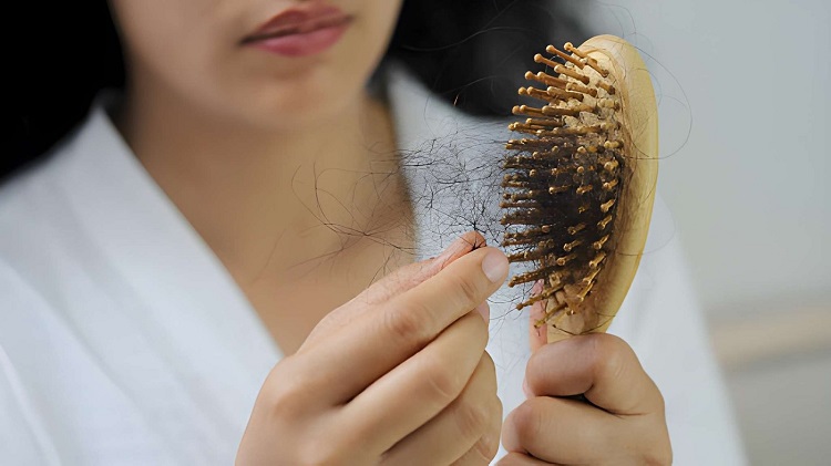 Women with hair loss dryness and frizziness