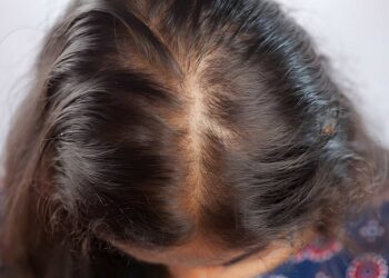 Women with messy hair having hair falling
