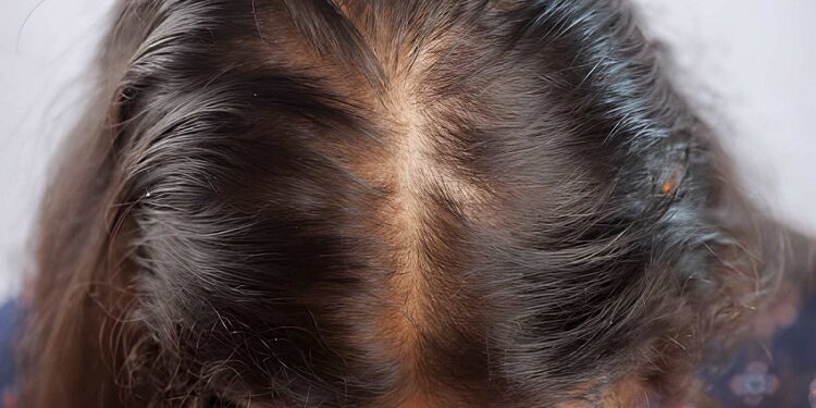 Women with messy hair having hair falling