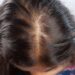 Women with messy hair having hair falling