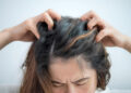 woman having Itchy scalp problem