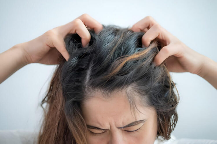 woman having Itchy scalp problem