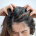 woman having Itchy scalp problem