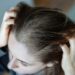 woman worried of scalp dandruff