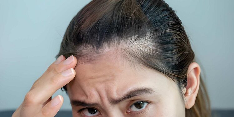 woman worrying about her forehead with part of her thin hair
