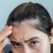 woman worrying about her forehead with part of her thin hair