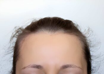 young woman's head with growing protruding hair