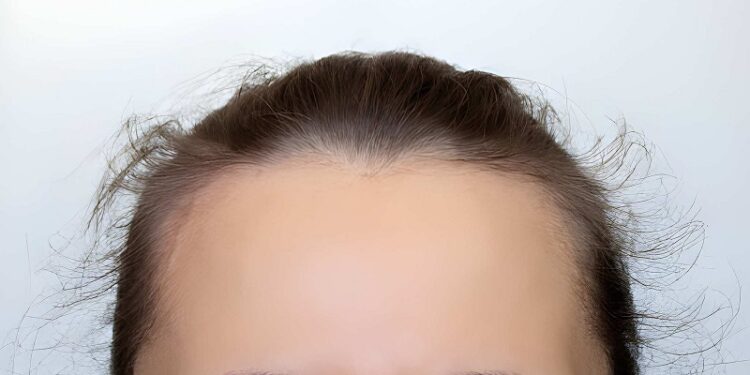 young woman's head with growing protruding hair