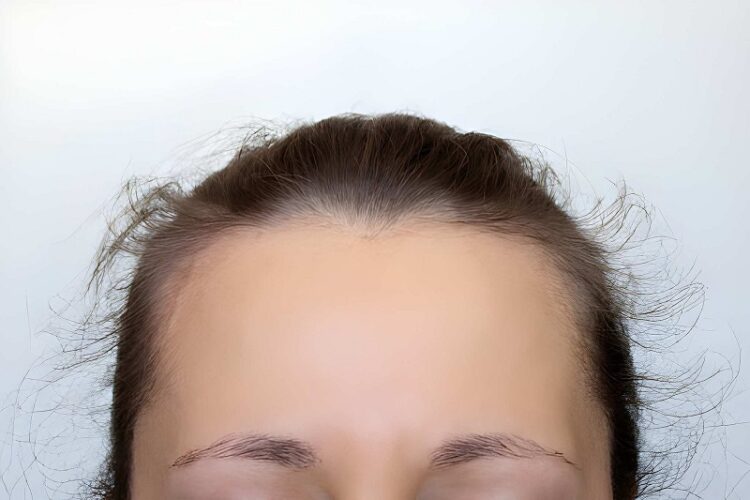 young woman's head with growing protruding hair