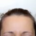 young woman's head with growing protruding hair