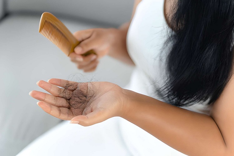 Hair fall problem