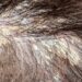 Woman's dandruff in the hair and scalp